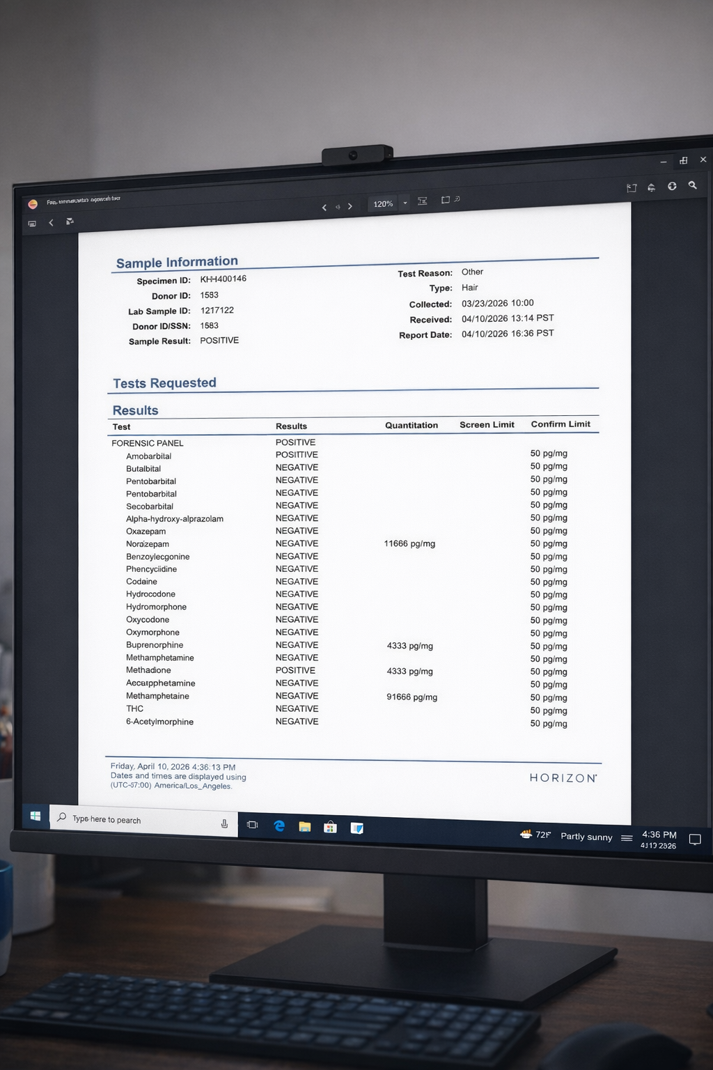 Sample screen of a redacted hair follicle test lab report.