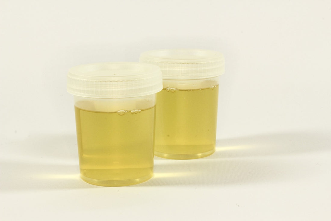 How Teens Fake or Compromise Urine Tests